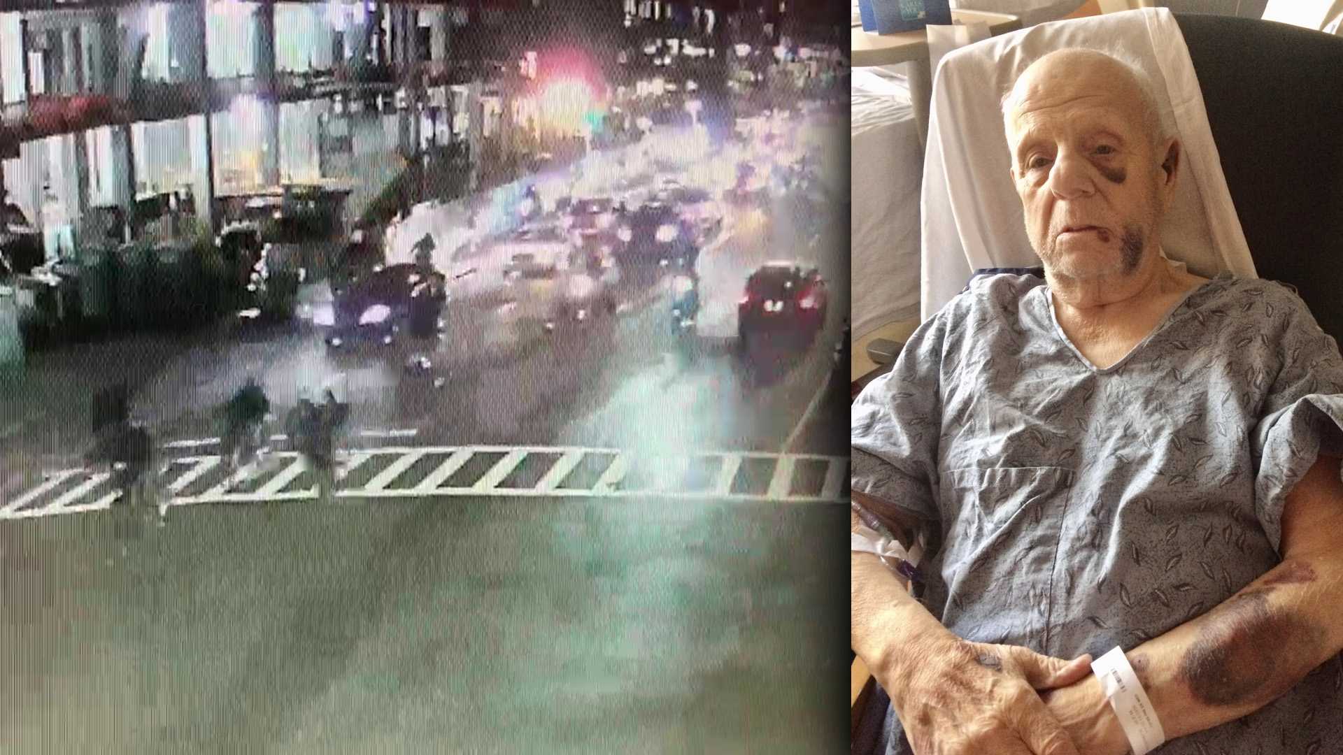 Boston elderly man attacked by ATV motorcycle rider