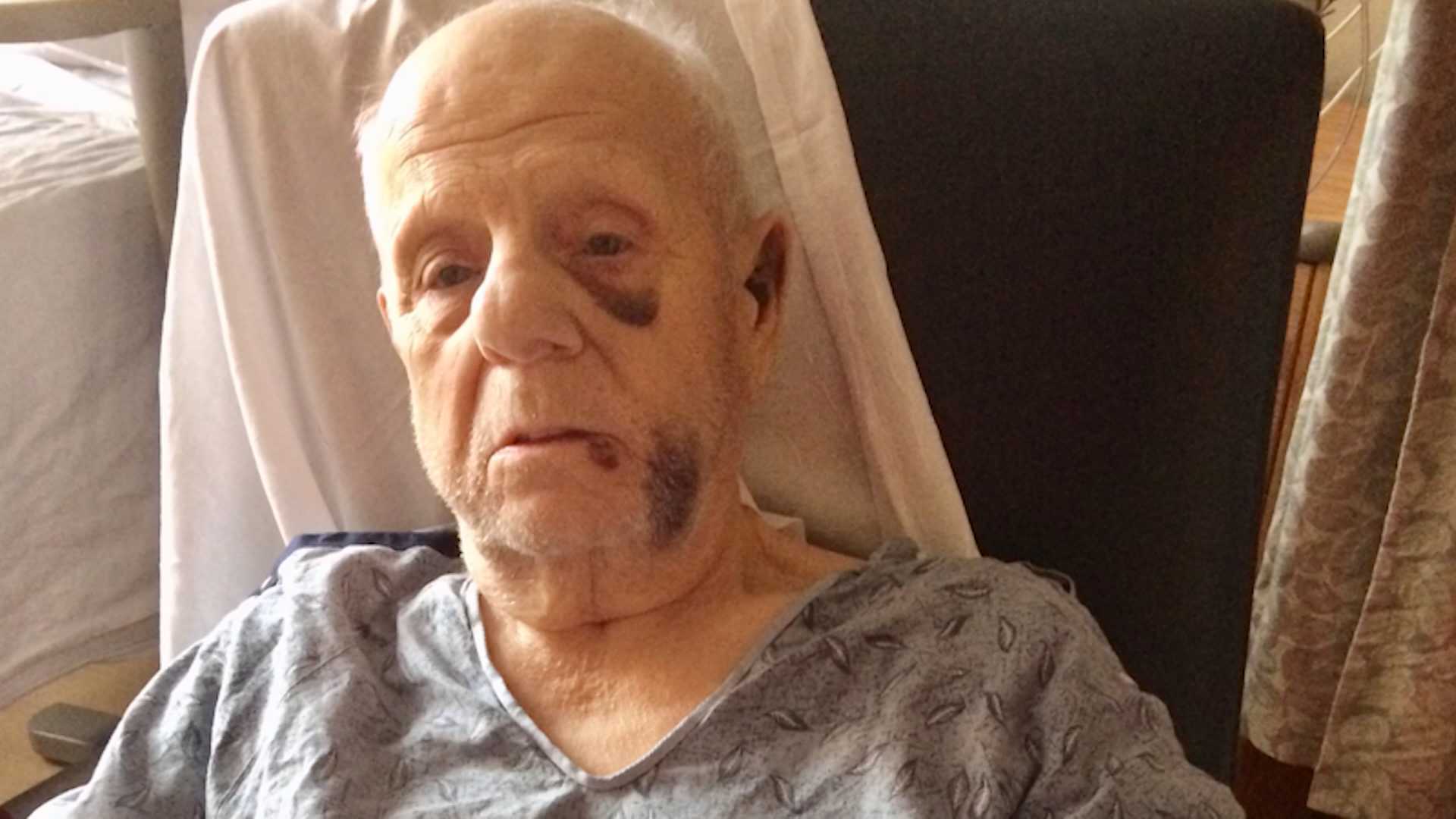 This 82 year old man was swarmed around and attacked by a pack of filth x20; bike and ATV riders in Boston on Nov. 18, 2021.